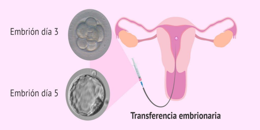 Explorando las Técnicas de Reproducción Asistida: De la Inseminación Artificial a la Transferencia de Embriones Explorando las Técnicas de Reproducción Asistida: De la Inseminación Artificial a la Transferencia de Embriones