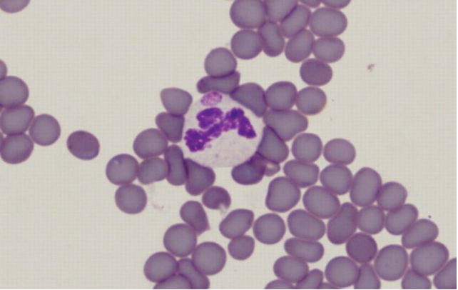 M&aacute;s All&aacute; de la Garrapata: Diagn&oacute;stico y Prevenci&oacute;n de la Anaplasmosis Bovina, un Desaf&iacute;o Silencioso en el Campo