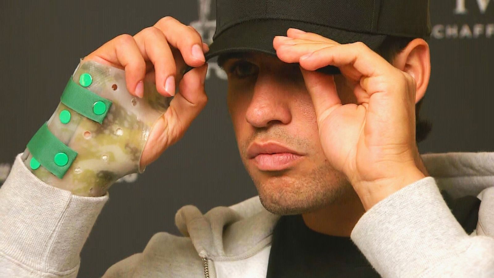 Noti-Deporte: Alcaraz ya sabe qu&eacute; lesi&oacute;n tiene en la mu&ntilde;eca: posible tiempo de baja