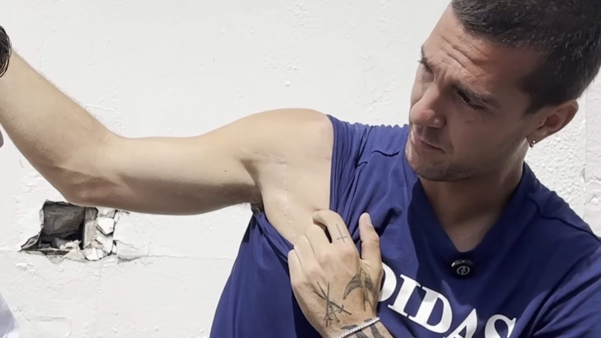 Noti-Deporte: "Juego con el pectoral a la mitad, el m&eacute;dico de Nadal no sab&iacute;a qu&eacute; hacer con esto"